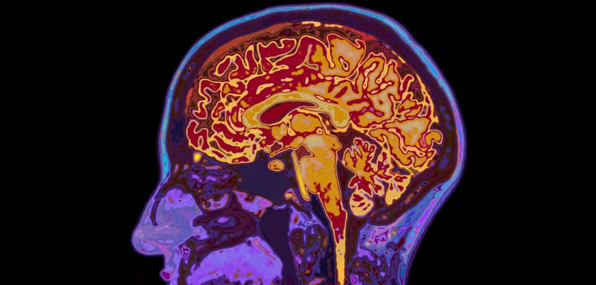 MRI scans reveal how brain protects memories | University of Oxford