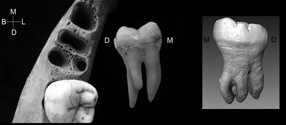 Figure 1 from Bailey et al. 2019, showing the three-rooted alveoli for M1 and CT scan of three-rooted M2 from the Xiahe mandible Figure 1 from Bailey et al. 2019, showing the three-rooted alveoli for M1 and CT scan of three-rooted M2 from the Xiahe mandible