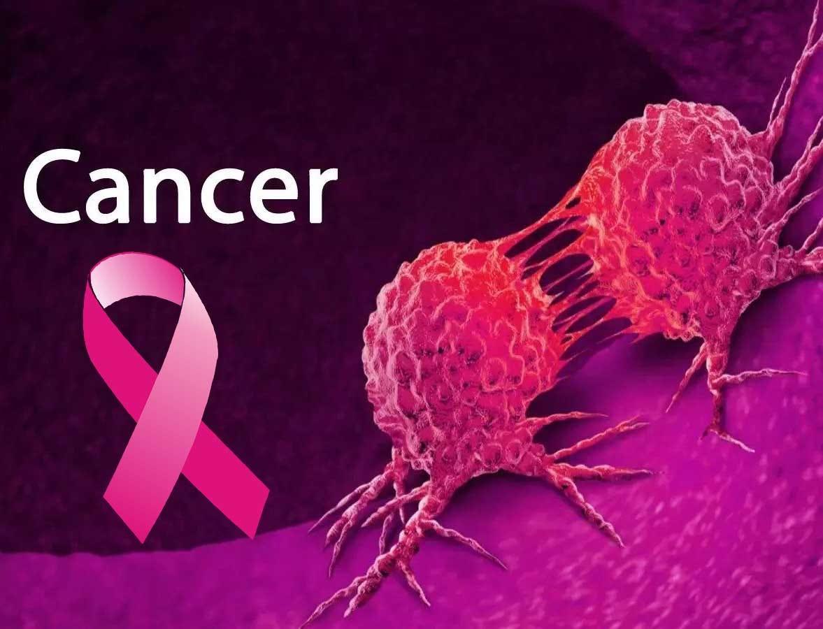 Cancer: Three key ways to prevent cancer | Quality Natural Supplements