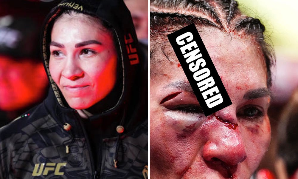 UFC 306 before/after photos: Irene Aldana's massive gory forehead cut