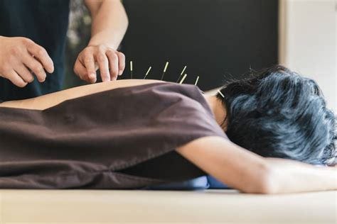 Why Physical Therapy And Acupuncture Together Improves Healing - Viral Rang