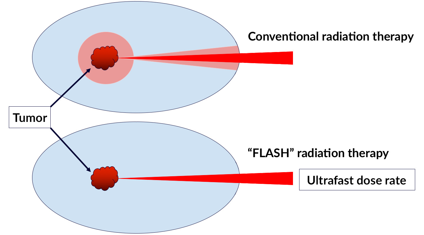 Drawing showing tumors (red blobs) in light blue ovals being irradiated by x-ray beams from the right. Top diagram (labeled “conventional radiation therapy”) shows pink halo around tumor. Bottom diagram (labeled “FLASH radiation therapy”) shows no halo.