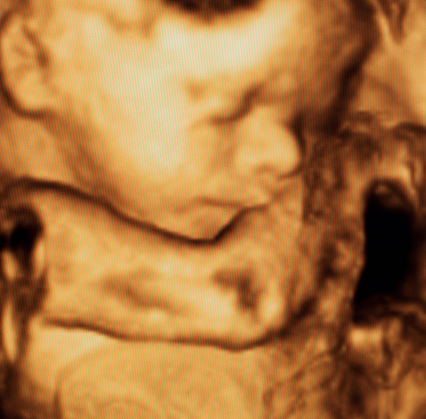 ultrasound of preborn baby, showing the face