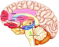 Brain regions with inflammatory ...