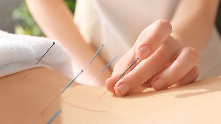 acupunctures ability to reduce pain