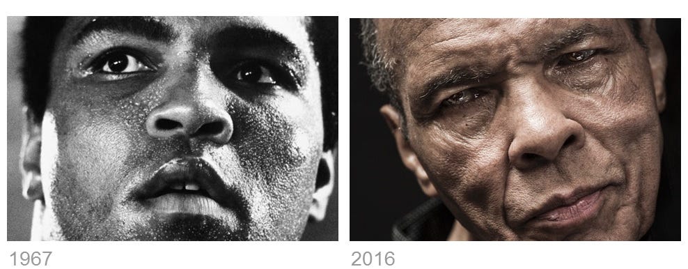 Was dopamine the secret to Muhammad Ali's greatness?