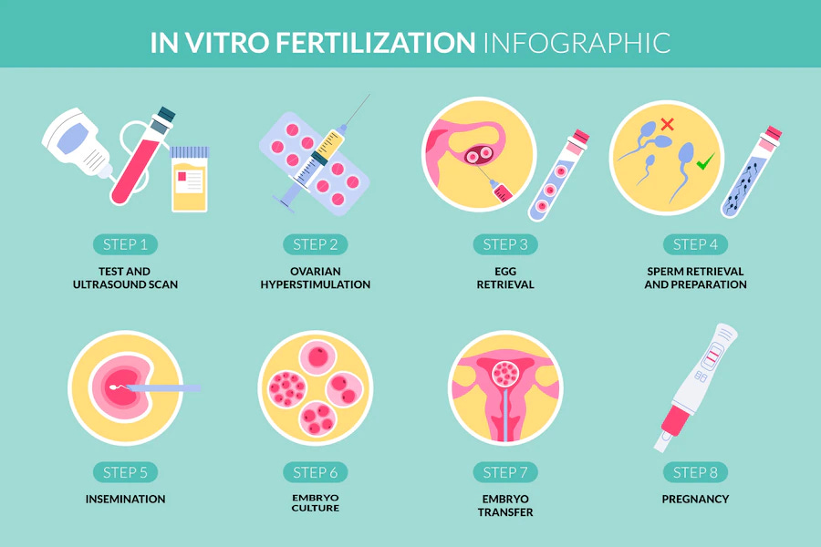 In-Vitro Fertilization (IVF)