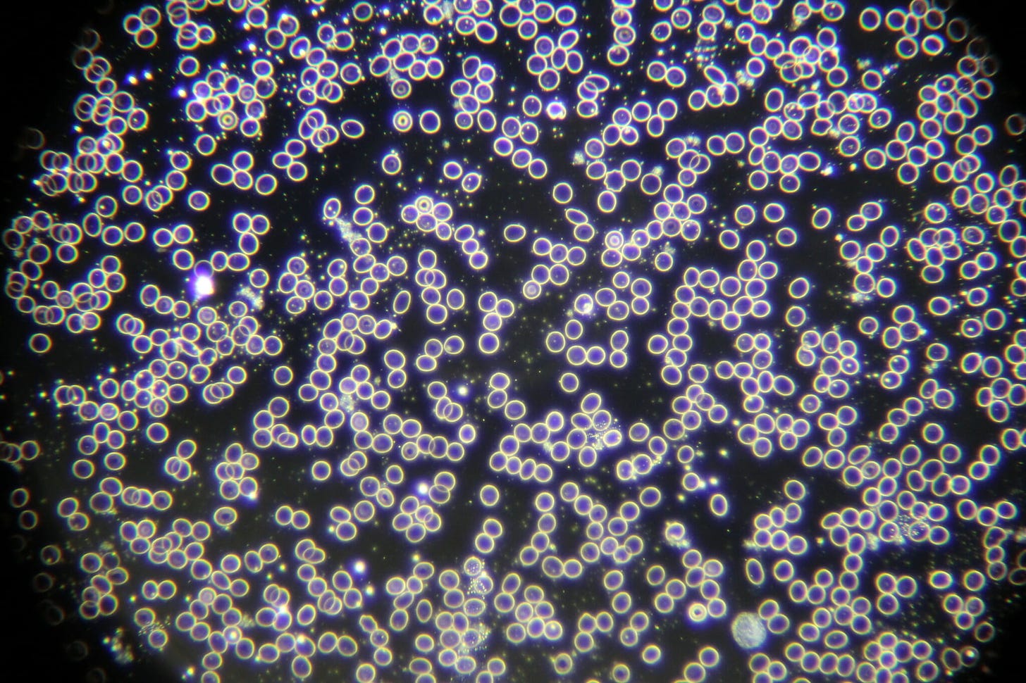 Dark field microscopy - electrosmog exposure visible | Waveguard