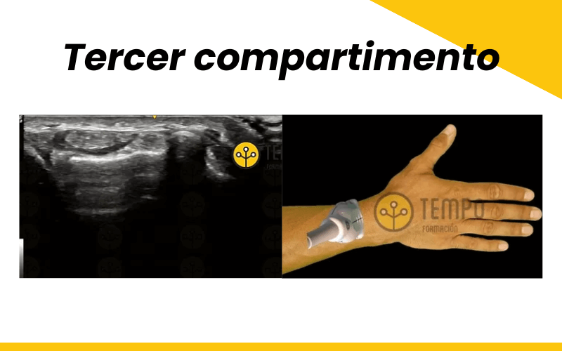 3. Tercer compartimento muñeca ecografia Tempo Formacion.png