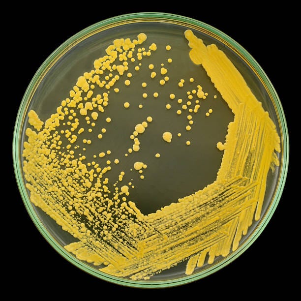 Bacteria Petri Dish Stock Photos, Pictures & Royalty-Free Images - iStock