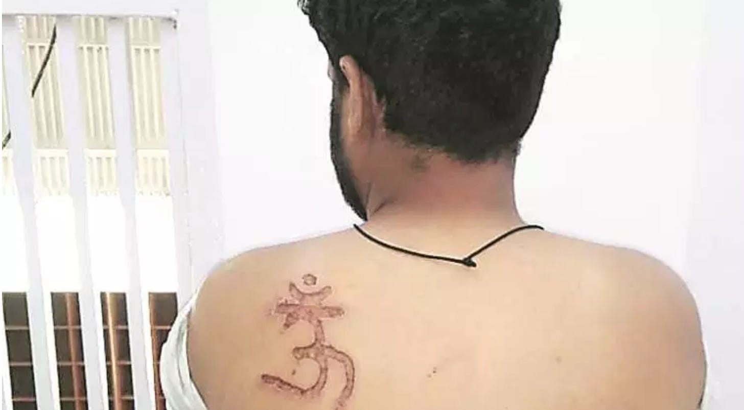 Secular grand-standing – how a Tihar Muslim inmate lied and accused Hindu jail official of Branding him with Om tattoo