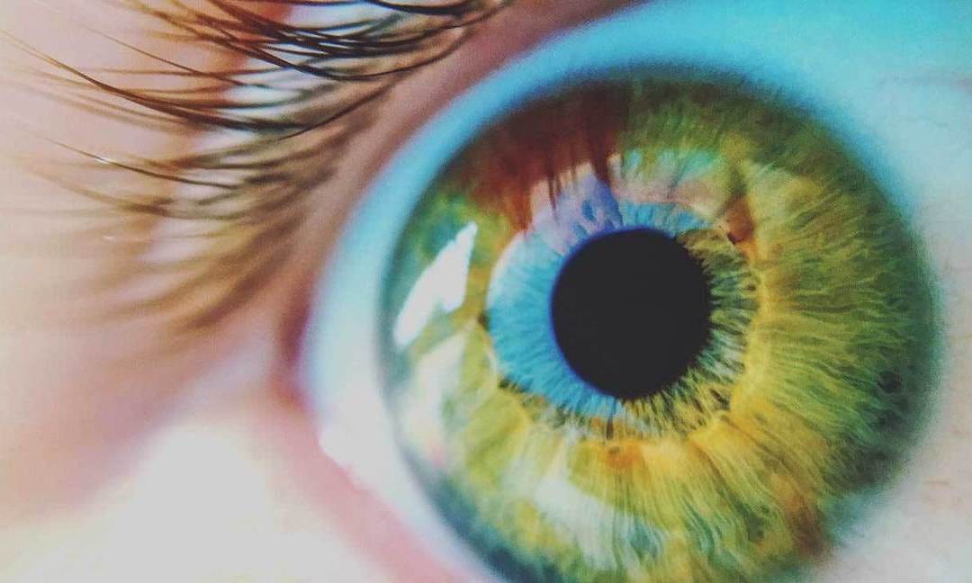 How to understand Age-Related Macular Degeneration?