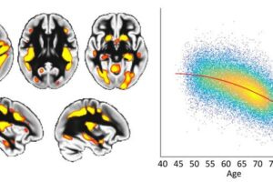 Image caption: To the left of the figure, the red-yellow colour denotes the regions that degenerate earlier than the rest of the brain, and are vulnerable to Alzheimer’s disease. These brain areas are higher-order regions that process and combine information coming from our different senses. To the right of the figure, each dot represents the brain data from one UK Biobank participant. The overall curve shows that, in these particularly fragile regions of the brain, there is accelerated degeneration with age. Credit: G. Douaud and J. Manuello.