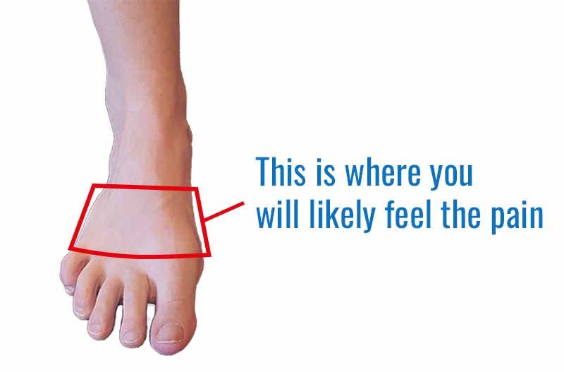 Metatarsal stress fractures – causes, symptoms, and treatment