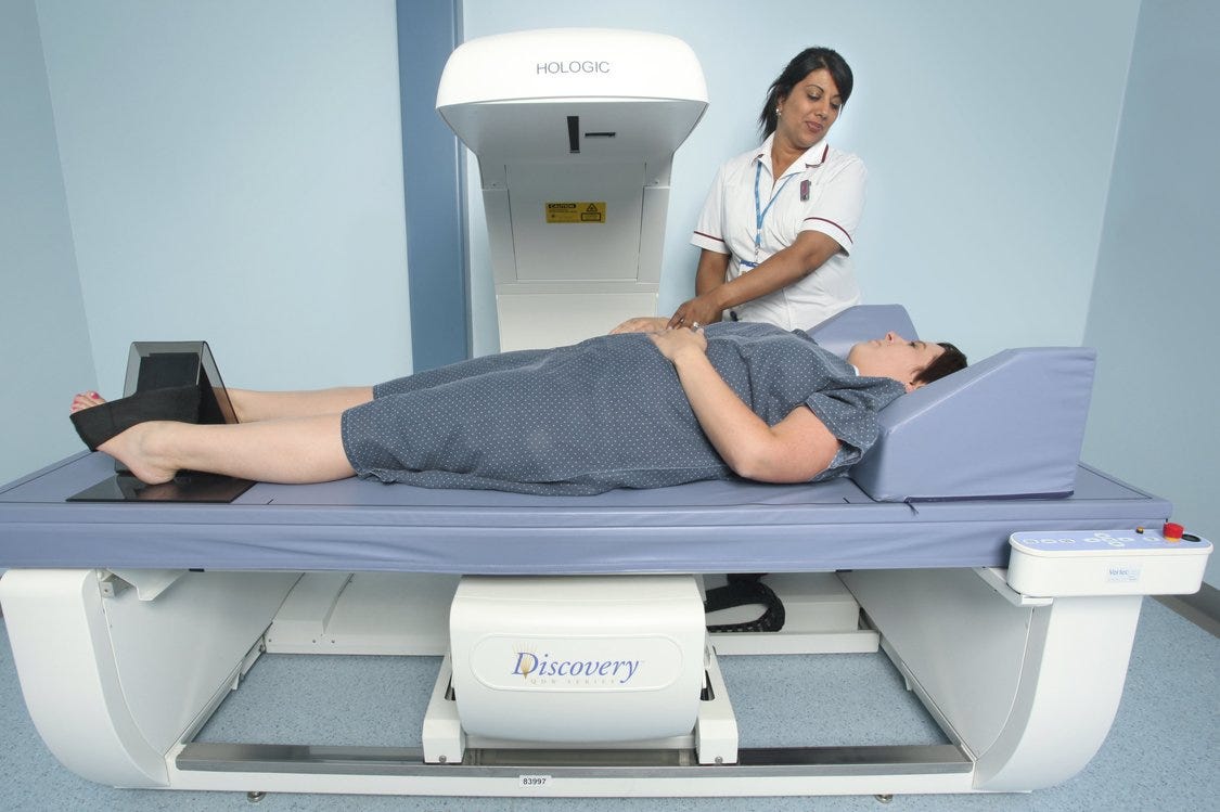 Bone density scan (DEXA scan) - How it is performed - NHS