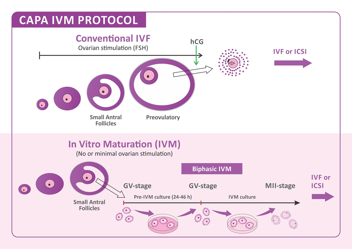 A New Drug-Free IVF Treatment - CAPA-IVM | Infertility treatment