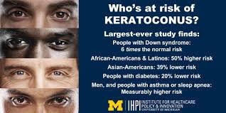 Image result for keratoconus Image result for keratoconus