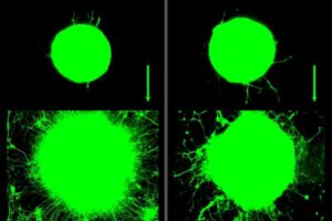 MIT scientists find that motor neuron growth increased significantly over 5 days in response to biochemical (left) and mechanical (right) signals related to exercise. The green ball represents cluster of neurons that grow outward in long tails, or axons.