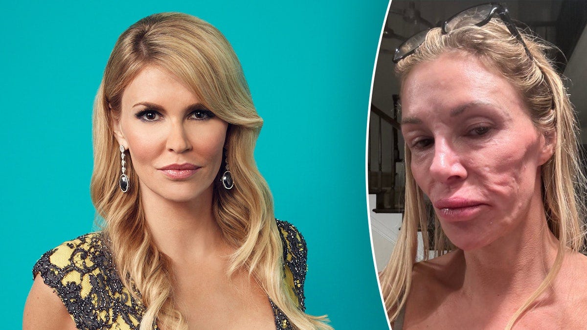 Brandi Glanville shares stripped down photo as she claims her 'looks are  ruined' by mystery illness | Fox News