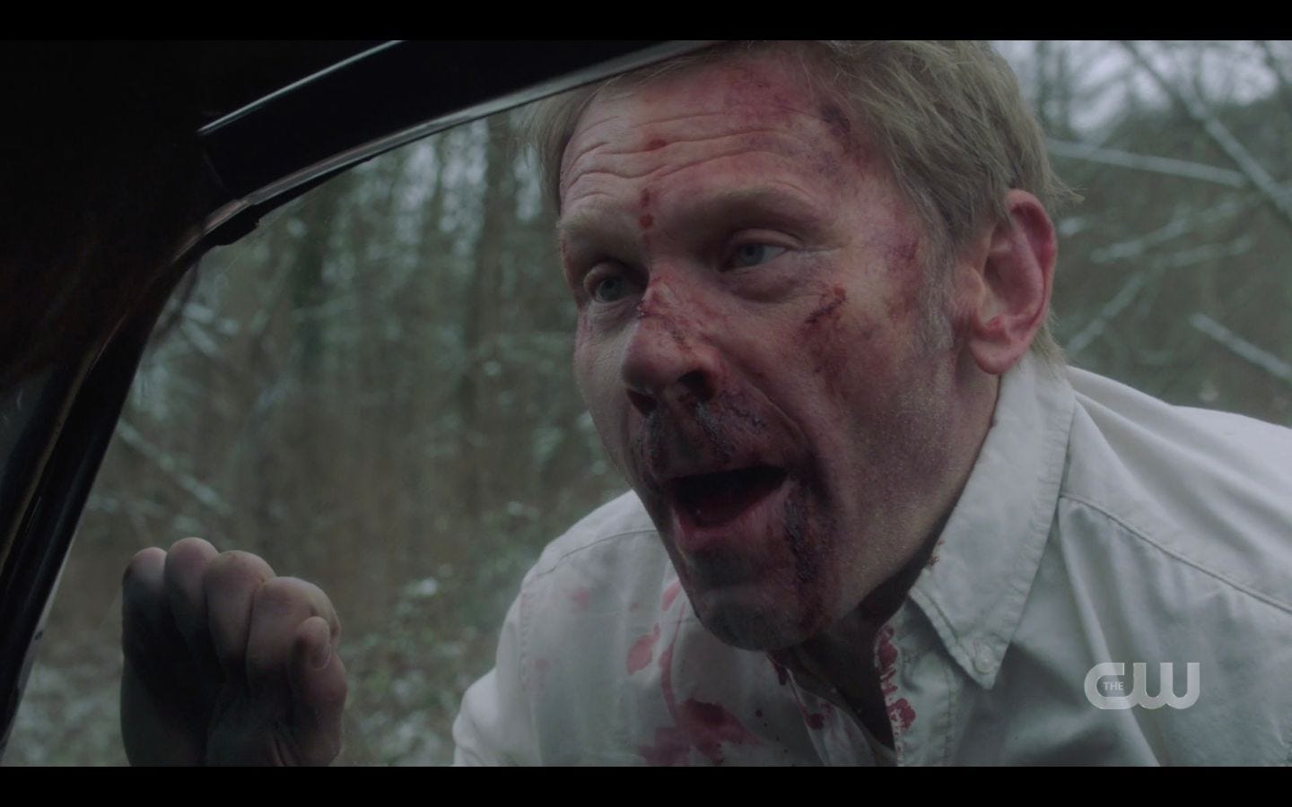 SPN 14.17 Mark Pellegrino Nick bloody face from choking out Sam