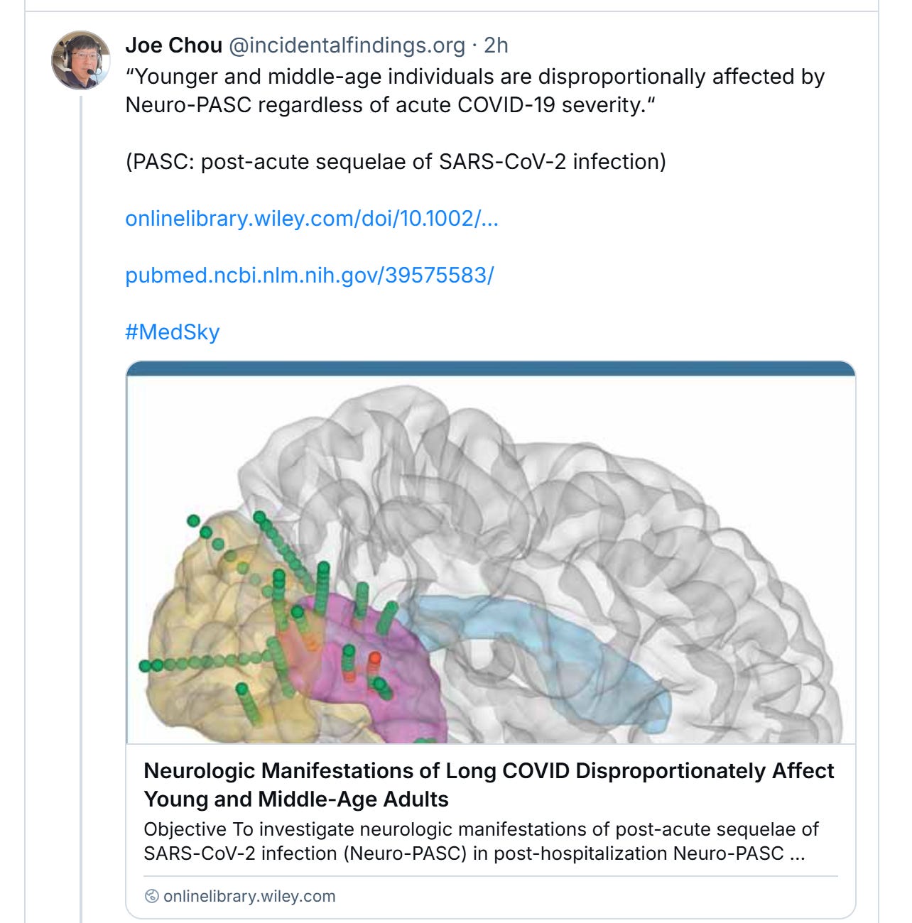 Screenshot from a Blue Sky post from Joe Chou. It links to an article, so the promo of the article shows a brain with some green dots over the frontal lobe. The post reads Joe Chou ‪@incidentalfindings.org‬ “Younger and middle-age individuals are disproportionally affected by Neuro-PASC regardless of acute COVID-19 severity.“  (PASC: post-acute sequelae of SARS-CoV-2 infection)  onlinelibrary.wiley.com/doi/10.1002/...  pubmed.ncbi.nlm.nih.gov/39575583/   #MedSky