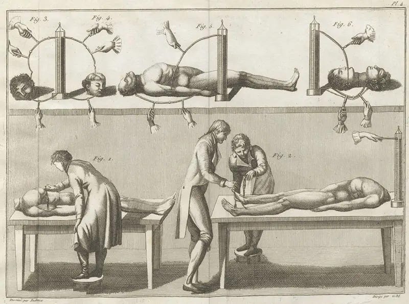 The Dark Experiments of Giovanni Aldini: The Shocking Science Behind the Reanimation of Corpses