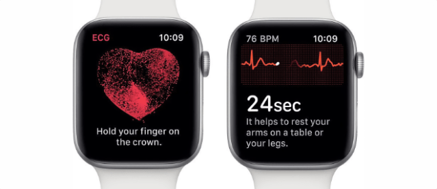 Apple Watch ECG