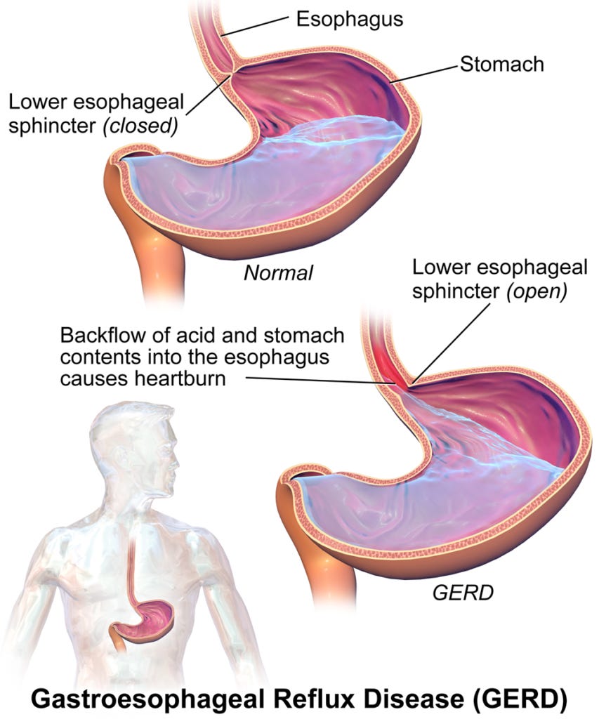 What Is Betaine HCl And Does It Help With Digestion?