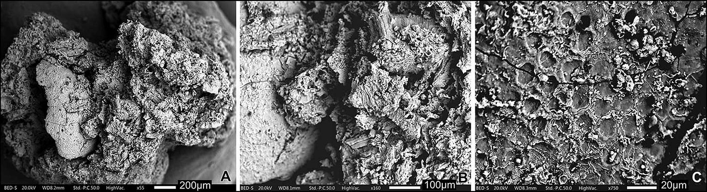 Three panels showing micrographs of a charred lump of food. A portion of a mustard seed is visible. Three panels showing micrographs of a charred lump of food. A portion of a mustard seed is visible.
