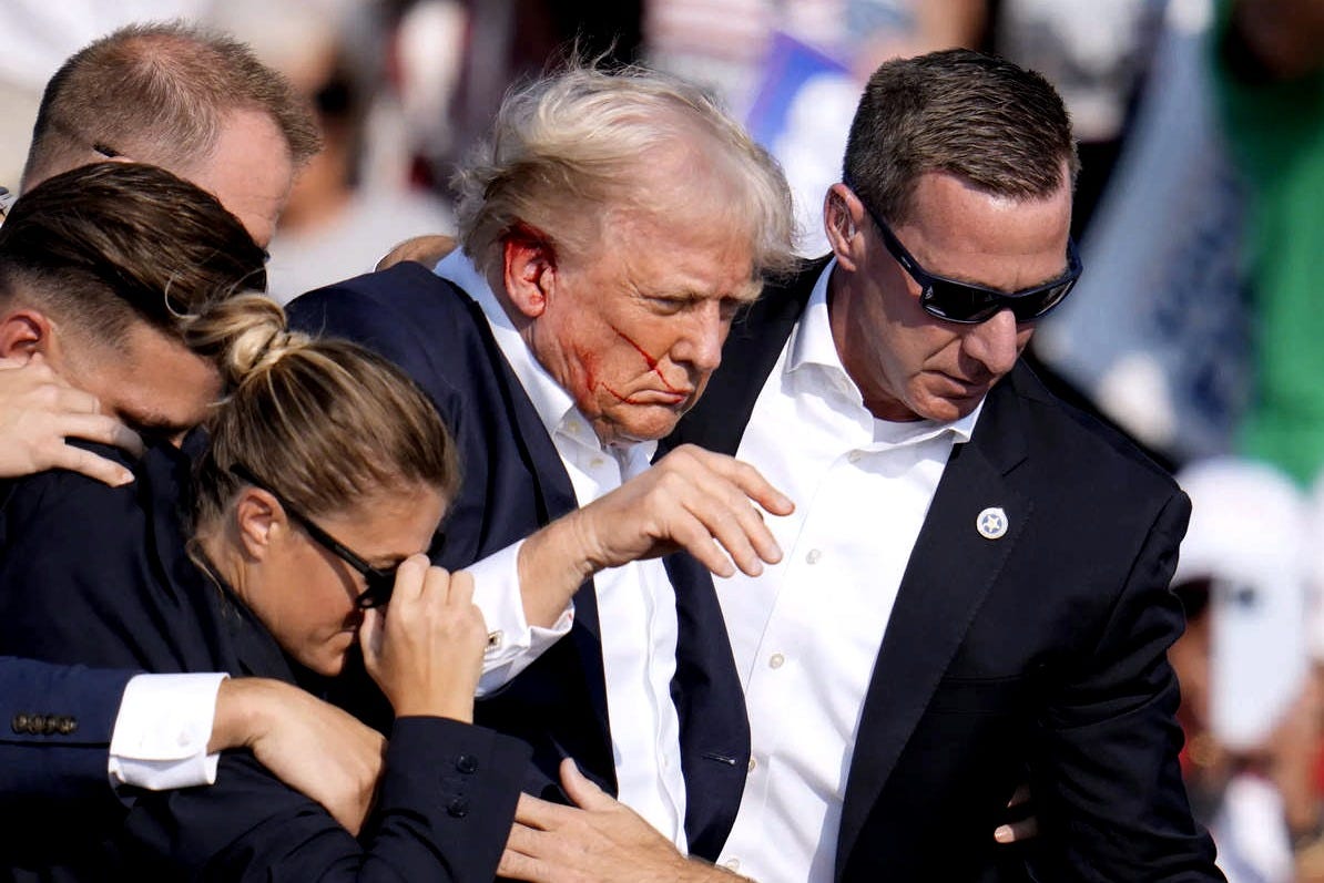 assassination attempt: Trump's health and treatment after the assassination  attempt? Here is what he underwent - The Economic Times