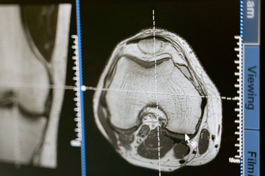 Free Close-up of an MRI scan displayed on a medical monitor, showcasing diagnostic medical imaging technology. Stock Photo