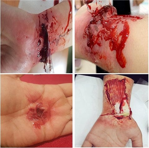 How to Use Moulage as a Simulation Tool in Medical Education?
