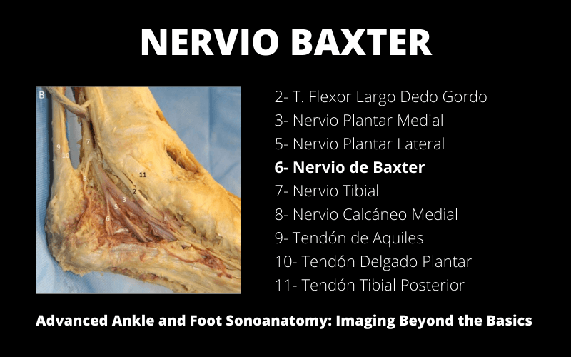 Anatomia Nervio Baxter Ecografia.png