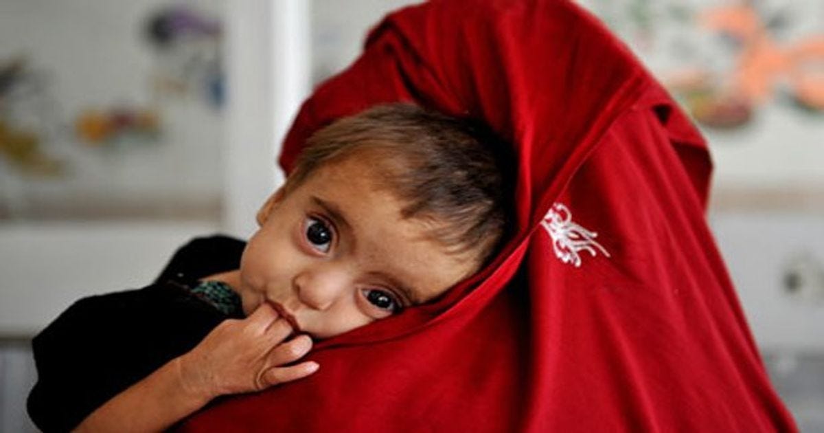 Pakistan ranked second to Afghanistan in the stunting growth index - Global  Village Space