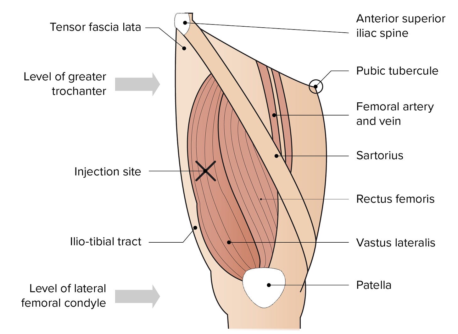 A diagram of the vestus lateralis injection site, courtesy of the Australian Health Department.