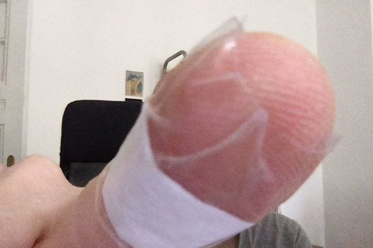 I cut my finger. Then none of my device fingerprint readers worked anymore. The future eh?