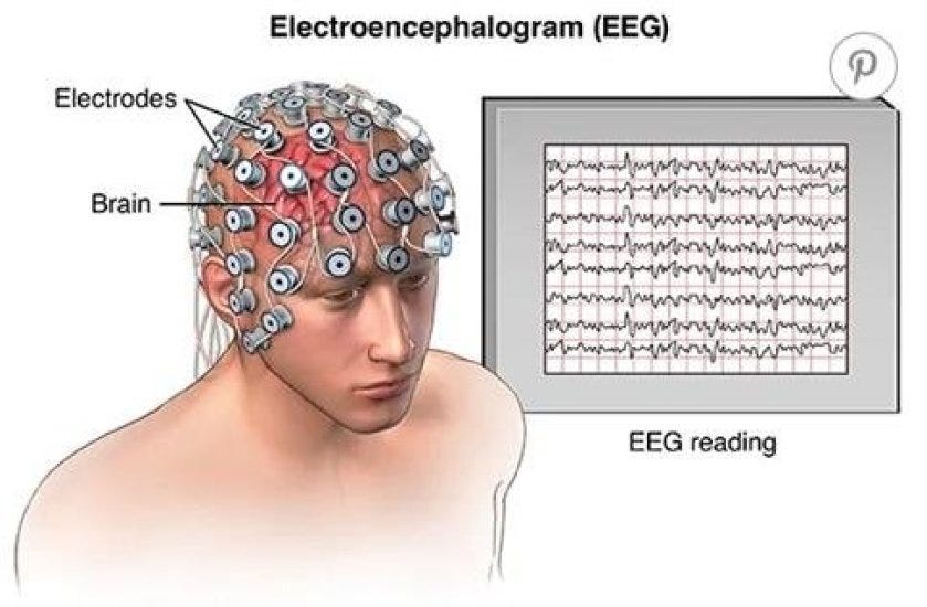 EEG AND BRAINWAVES - BRIGHT BRAIN - LONDON'S EEG, NEUROFEEDBACK AND BRAIN  STIMULATION CENTRE