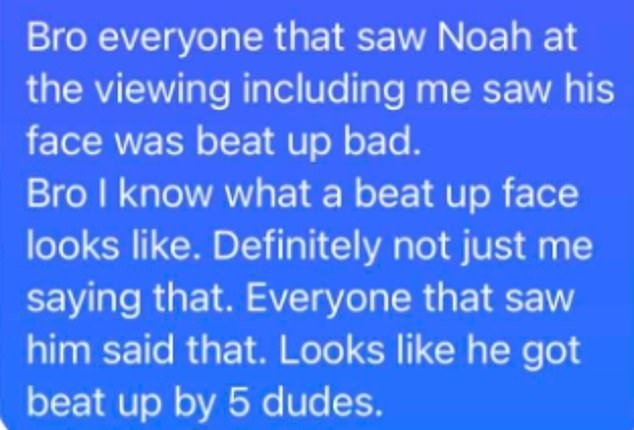 A friend who wasn't at the party questioned one of the teenagers in the weeks that followed about what happened to cause his facial injuries