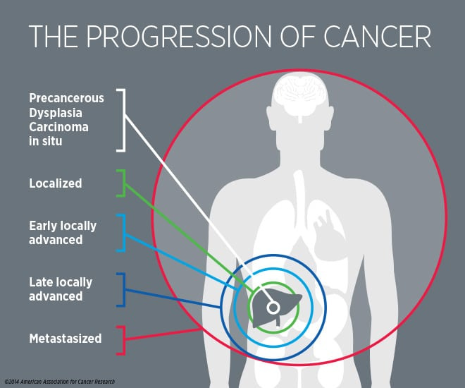 What Is Cancer? | Patients and Caregivers | AACR