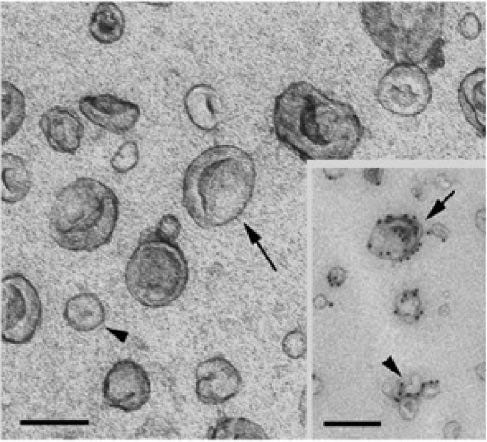 Figure 2: Electron micrographs of dendritic cell derived exosomes and microvesicles. The size bars in the EM images indicate 100 nm. The images were reproduced with permission from (19).