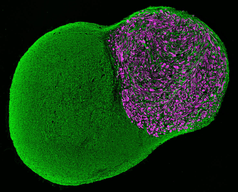 lab-grown neuro-musculature organoid