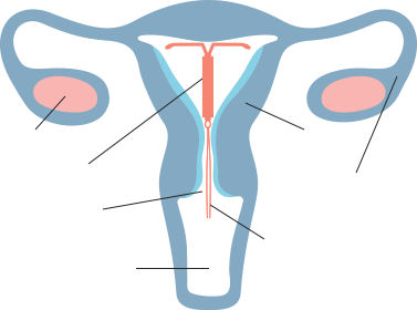 How Does LILETTA® IUS (also known as IUD) Work? | Official Site