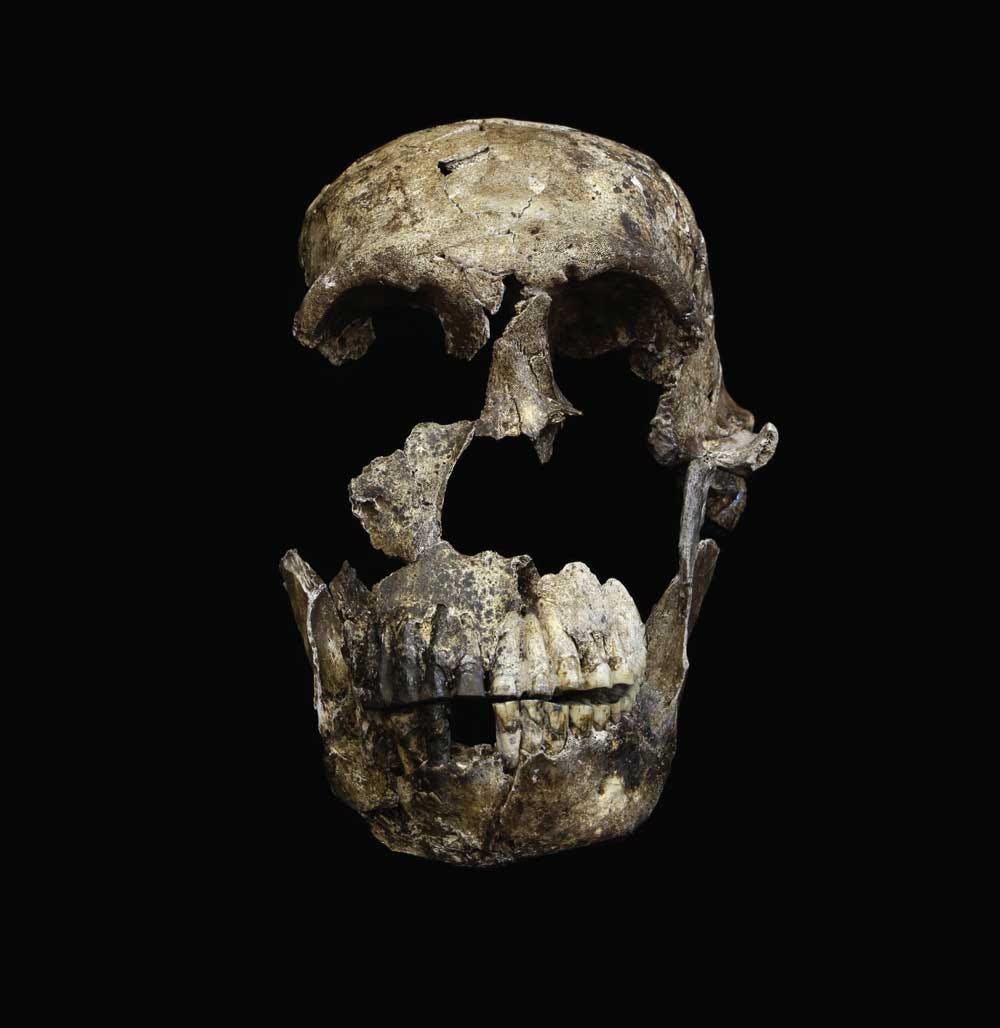 Neo skull frontal view
