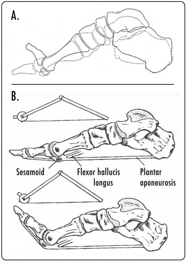 WINDLASS MECHANISM OF THE FOOT | ACE Physical Therapy and Sports Medicine  Institute