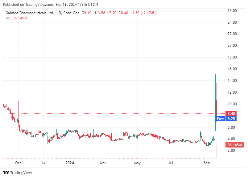 TradingView chart