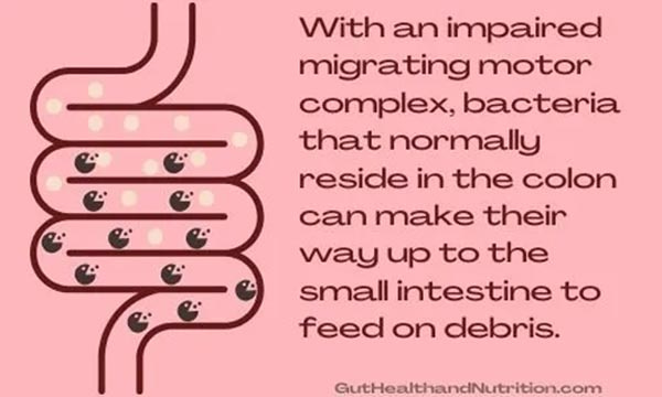 impaired migrating motor complex