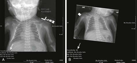 Radiation Bioeffects, Risks, and Radiation Protection in Medical Imaging in Children | Radiology Key Radiation Bioeffects, Risks, and Radiation Protection in Medical Imaging in Children | Radiology Key