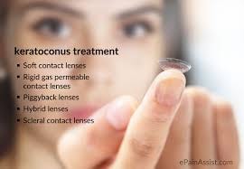 Image result for keratoconus Image result for keratoconus