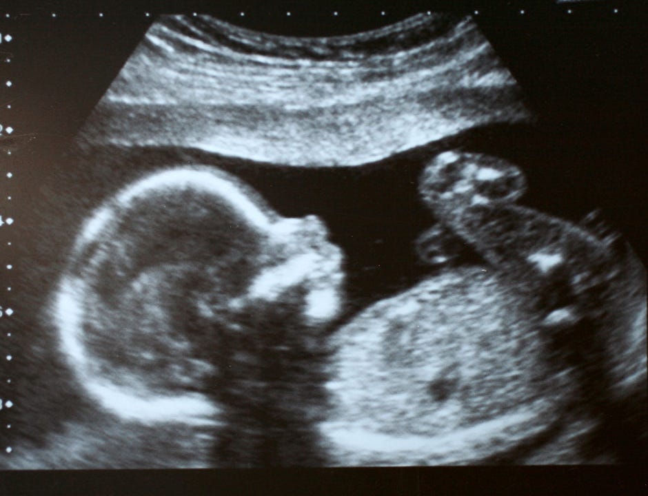 ultrasound of preborn baby ultrasound of preborn baby