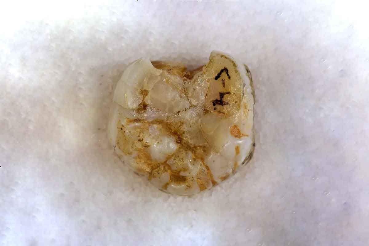 Denisova 8 molar